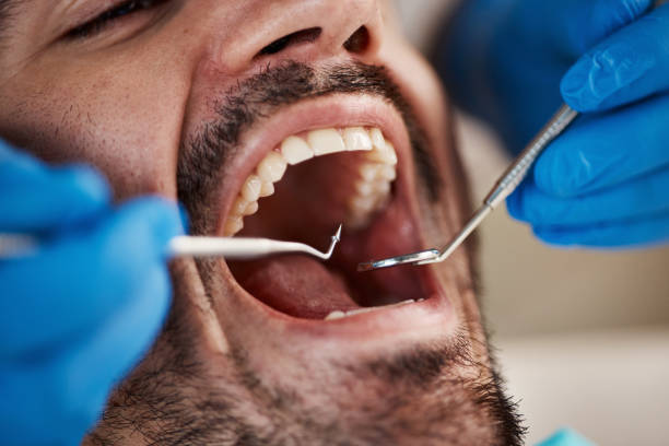 Best Tooth Infection Emergency Dentist  in Washington, KS